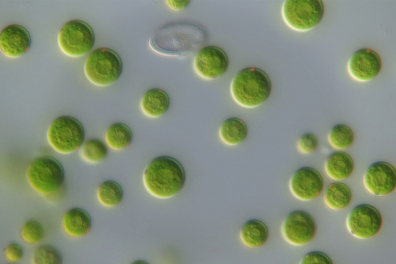 Observation d'algues unicellulaires d'eau douce